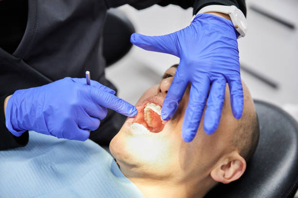 Best Urgent Care for Lost Fillings or Crowns in Difficult Run, VA